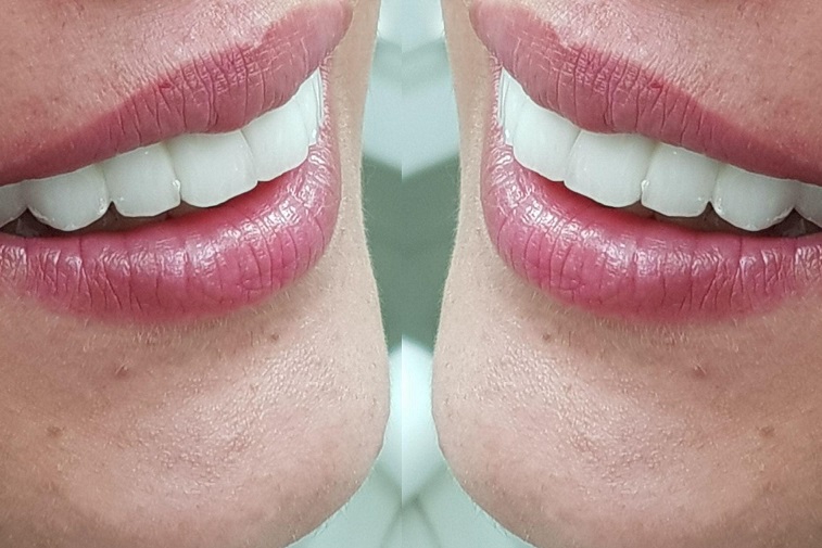 מרפאת שיניים יישור והשתלת שיניים