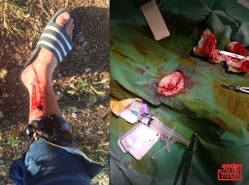 פורטל הכרמל