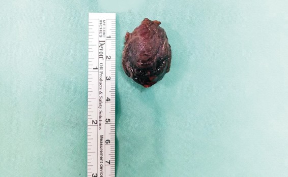 "קיבלנו את הילד במתנה"