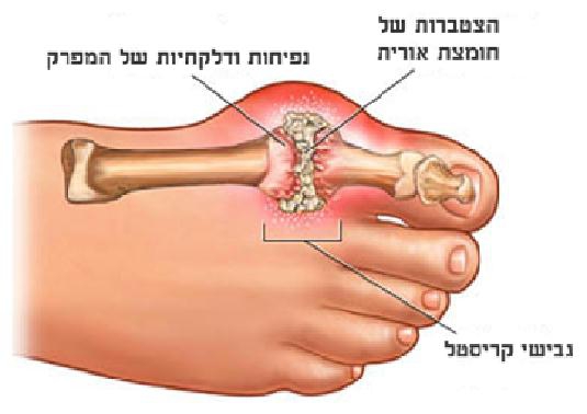 פורטל הכרמל