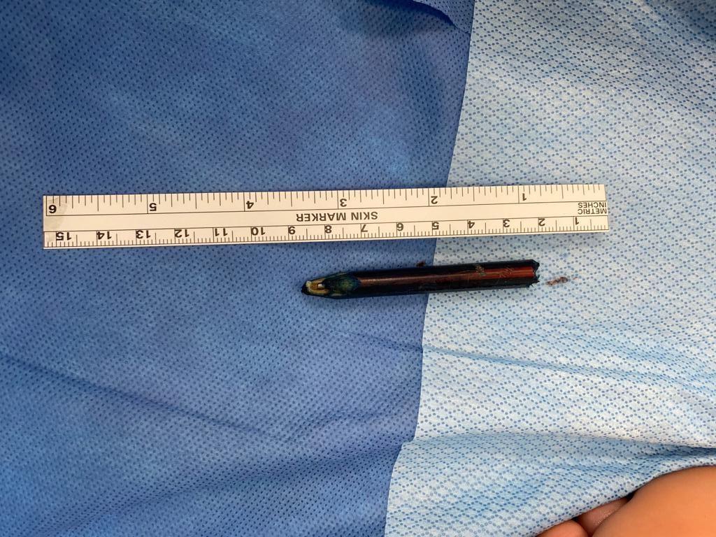 פרופ' מרק אידלמן "המשחק נגמר בהחדרת עיפרון לגופו של הילד"