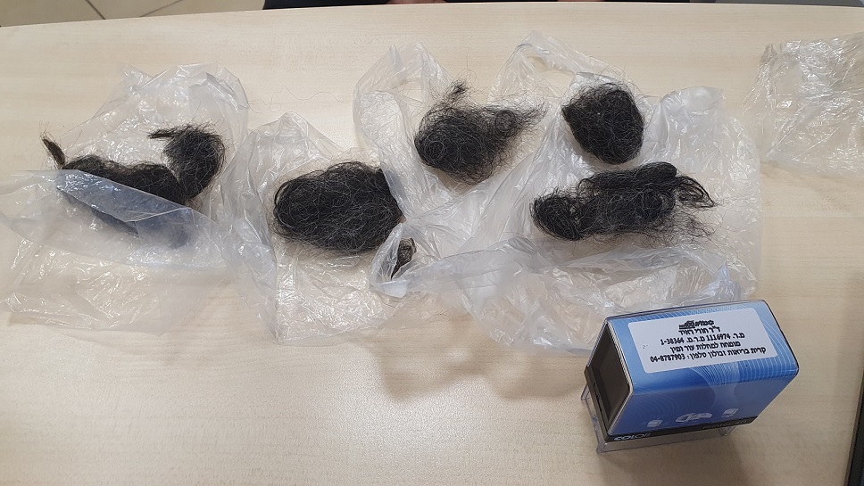 מחלימי קורונה רבים סובלים מהתקרחות