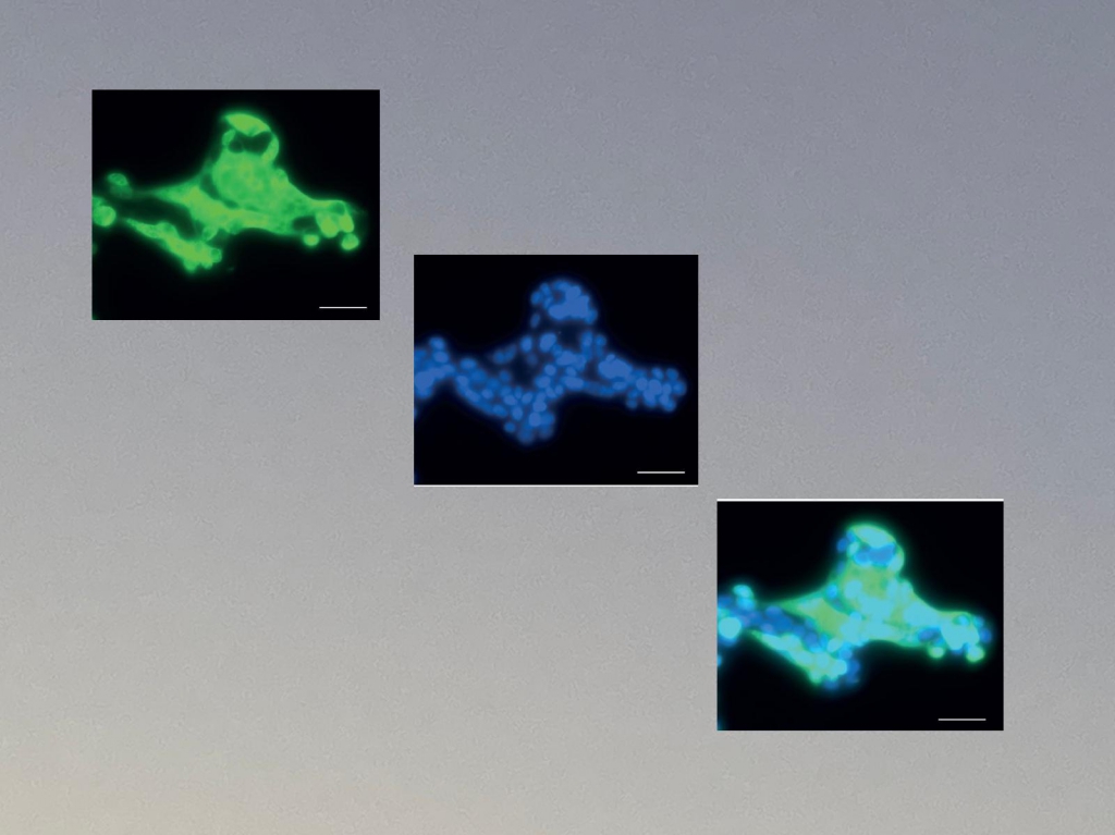 שילוב ייחודי של שלושה מנגנונים מאפשר לנגיף לחמוק מהמערכת החיסונית