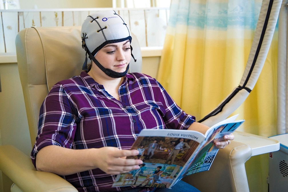 האם אפשר למנוע נשירת שיער בטיפול כימותרפי לסרטן השד?