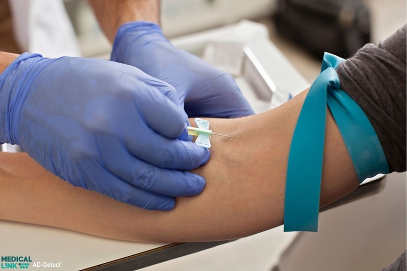 בדיקת דם פשוטה תאפשר אבחון מוקדם של אלצהיימר