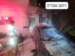 אדם נפגע בשריפת רכב בחיפה