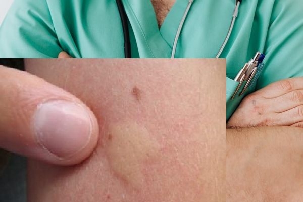 מבט המקיף ביותר על מחלות אוטואימוניות בעור