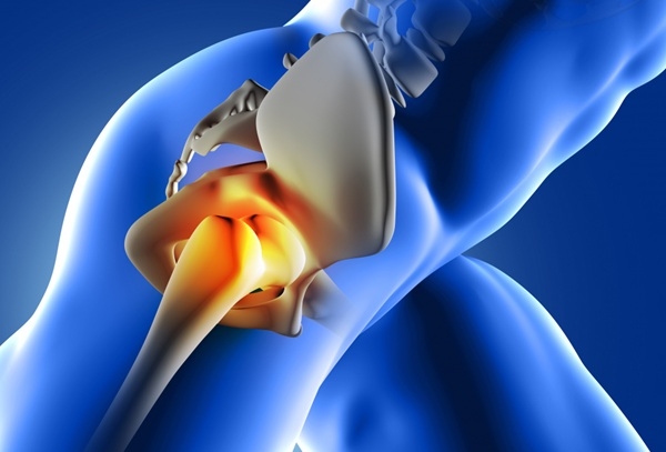 כל מה שצריך לדעת לפני ואחרי ניתוח מפרק הירך