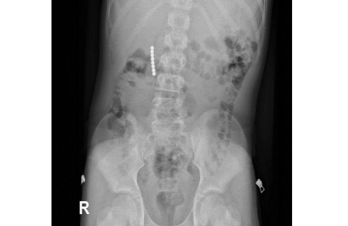 פורטל הכרמל