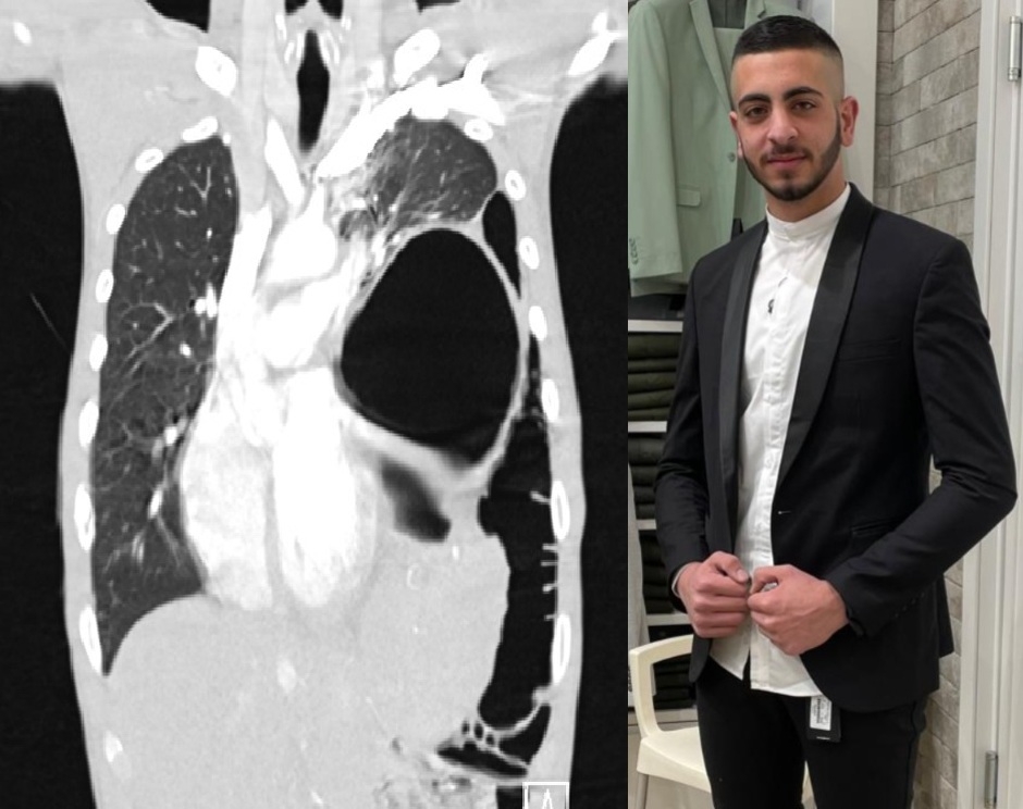 הפציעה הסמויה שחייבה ניתוח