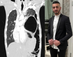 הפציעה הסמויה שחייבה ניתוח