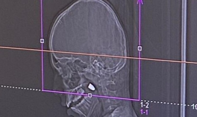 פורטל הכרמל