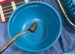 קליע נשלף בניתוח מראשו של ילד