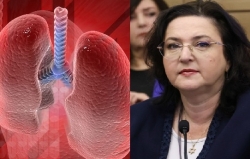 1.5 מיליארד ₪ הנזק לכלכלת ישראל ממחלת ריאות כרונית