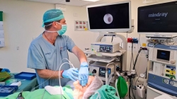 סוף לניתוחים המורכבים בפנים