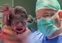 התאומים נולדו בניתוח קיסרי תחת אש